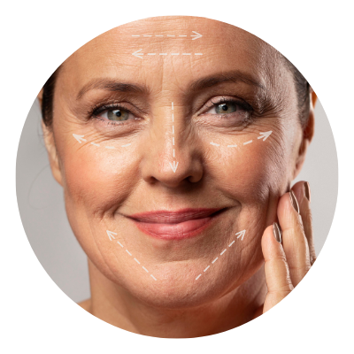 harmonização facial